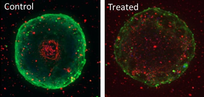 Spheroid Control vs Treated