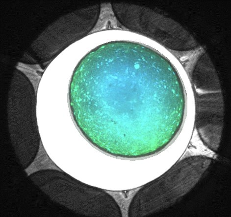 Neurospheroid in flowchip sample well