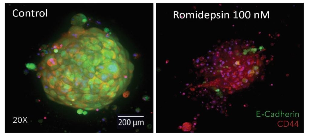 TNBC organoids