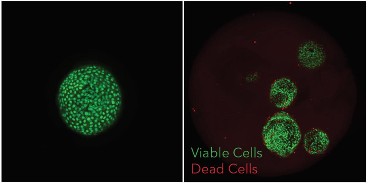 lung organoids stained in matrigel