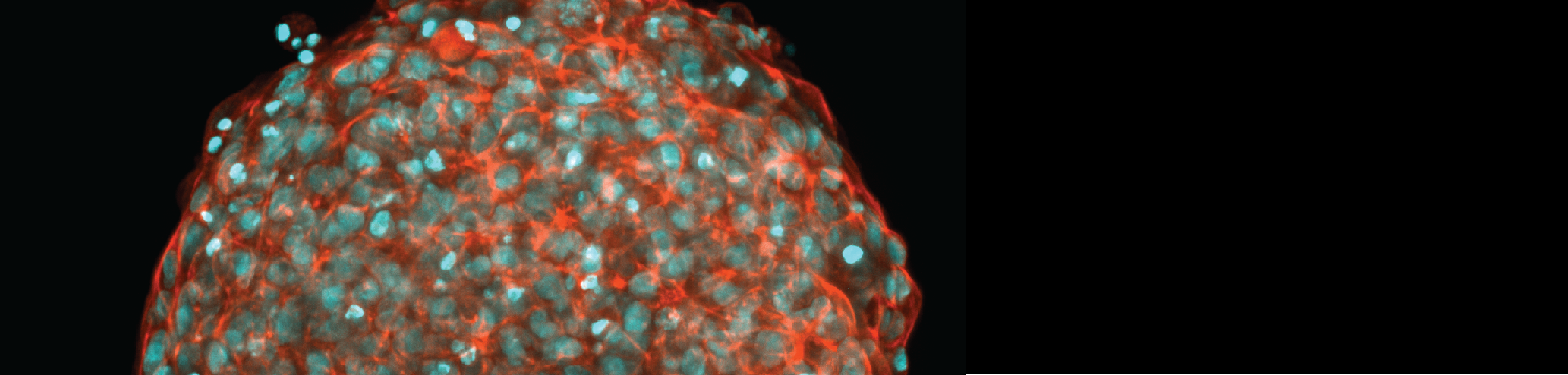 automated IF staining of spheroids and organoids